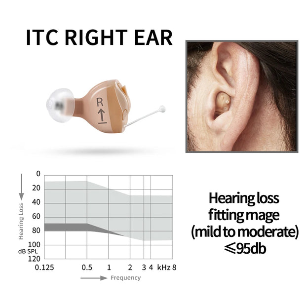 Rexton InoX 5A  Invisible ITC CIC Hearing Aid 8 Channels Digital Mobile Phone APP Program Fitting for People with Mild to Severe