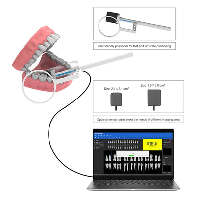 Dental Sensor X-Ray Radiovisiograph High-Frequency Rx Digital Intraoral Digital System Image Dentistry Tool